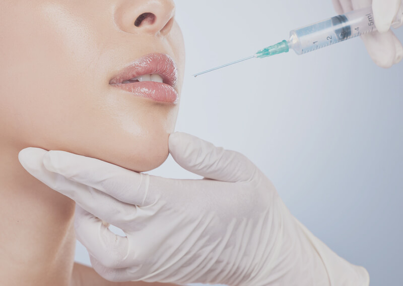 Injectare Acid Hialuronic